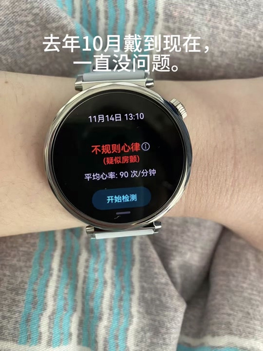 华为手表盘删除助手游戏截图