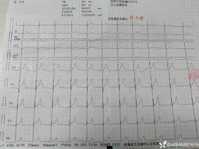v1到v6正常图解