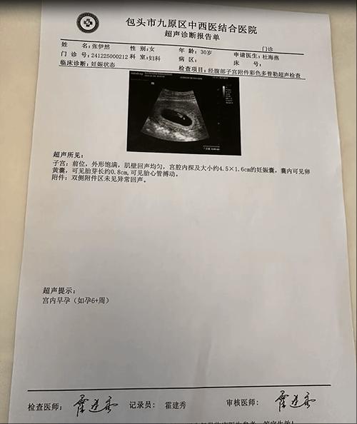 40天b超单子图片